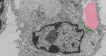 Scientists Discover New Heart Attack Repair Pathway