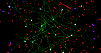 Mapping the Visual System, From Photoreceptors to Brain