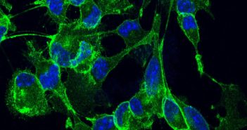New Insights Into Role of RNA Methylation in Fragile X Syndrome