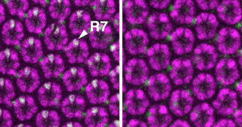 Slowing Metabolism Can Prevent Detrimental Effects of Genetic Mutations
