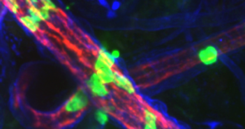 Newly Discovered Mechanism May Control Inflammation
