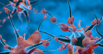 New Developments in Quest for Huntington’s Disease Treatments