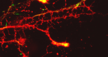 Revived Drug May Serve as New Parkinson’s Treatment