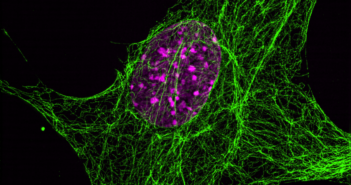 Protein Protects Nucleus from Rupture