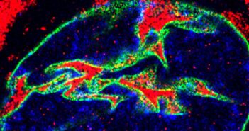 Uncovering the Cellular Mechanisms Behind Genetic Mutations in ALS