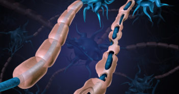 Gold-plated Nanocrystals Could Help Fight Multiple Sclerosis