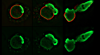 Unraveling the Cellular Mechanisms Behind Inflammation