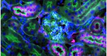 Study Finds Broad Therapeutic Potential for Nanoparticles