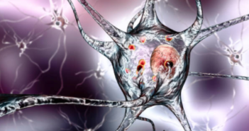 Specialized Immune Cells May Improve Early Detection of Parkinson’s Disease