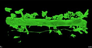 Unexpected Diversity in Neuronal Spine Projections