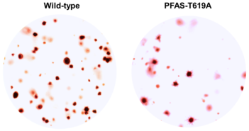Cancer Cells Hijack Nucleotide Metabolism to Boost Cell Proliferation