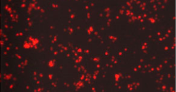 Novel Method Maps Virus-Host Protein Interactions