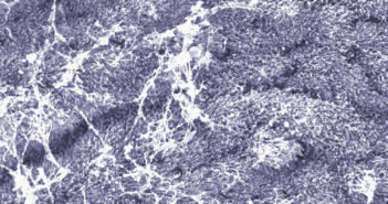 Critical Function of Cilia Protein Discovered