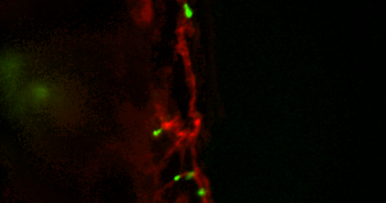Exploring Protein Vital for Bone Marrow Transplants