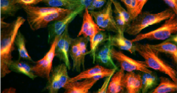 Protein Paves the Way for Early HIV Infection