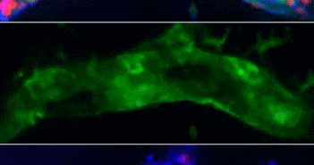 New Understanding of Leukocyte Migration