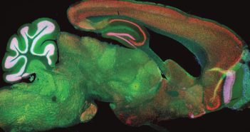 Study Provides Insights into the Development of Alzheimer’s
