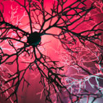 Combination Therapy Reduces Toxic Aggregates in Parkinson’s Disease