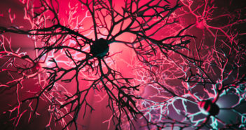 Drug for Advanced Parkinson’s Shows No Benefit