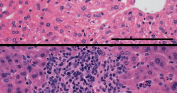 New Details on T-Cell Methylation