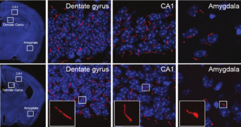 Cilia Defects Linked to Schizophrenia