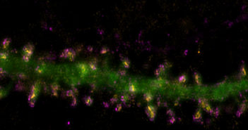 Uncovering the Impact of Protein Mutations in Parkinson’s