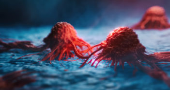 Study Identifies New Therapeutic Target for Most Common Type of Pancreatic Cancer
