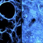 Changes in Macrophages Drive Vulnerability to Lung Infections