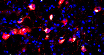 New Developments in Parkinson’s Pathology