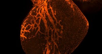 Rethinking Cardiac Repair After Injury