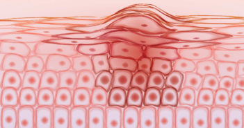 Molecular Research Builds New Understanding of Skin Regeneration
