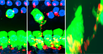 ‘Logic Circuit’ in Cochlear Neurodevelopment Identified