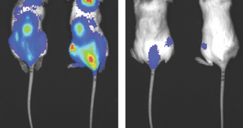 Leukemia Hijacks Nucleotide Metabolism