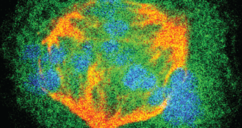 Blocking Cell Division in Glioblastoma