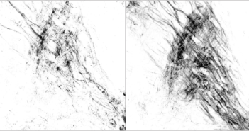 Mapping Neural Connections in Parkinson’s Disease