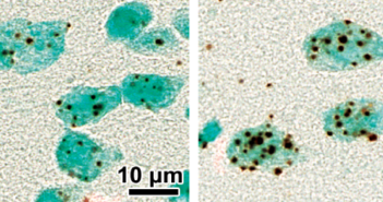 Transporter Imbalance Implicated in Schizophrenia