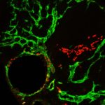Mitochondria Play Key Role in Lymphatic Development