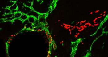 Mitochondria Play Key Role in Lymphatic Development