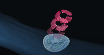 ‘Sweat Sticker’ Diagnoses Cystic Fibrosis on The Skin in Real Time
