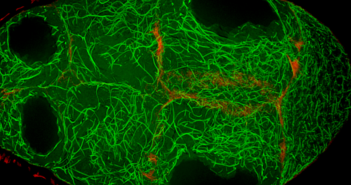 Crosslinker Protein Helps Egg Cells Develop