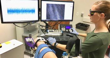 Muscle’s Smallest Building Blocks Disappear After Stroke