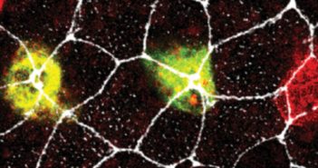 Strengthened Microtubules Aid Cell Migration