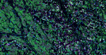Hypoxic Inflammation Blunts Repair After Heart Attack