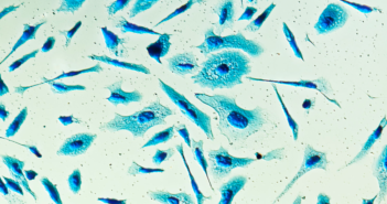 For Every Man: Northwestern Investigators’ Critical Impact on Prostate Cancer