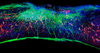 ‘Dancing Molecules’ Successfully Repair Severe Spinal Cord Injuries