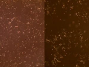 Airway epithelial cells from children between 2-3 years of age. Left is control, right is after RSV infection.