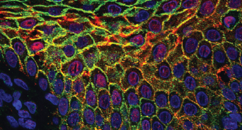 Uncovering Cellular Mechanisms of Genetic Skin Diseases