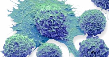 Balancing Act: The Science of Inflammation
